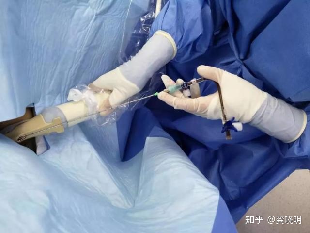 黄石大陆首个借卵试管婴儿，再过5天就30岁了......但借卵试管婴儿之母并没有等到这一天