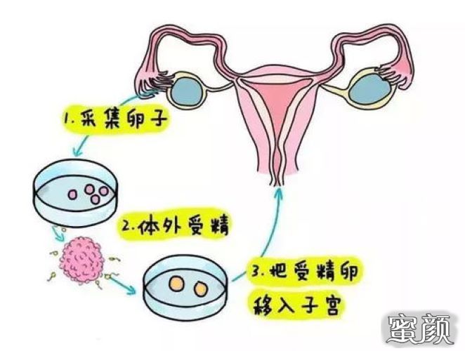 做供卵试管公立需要做什么检查什么