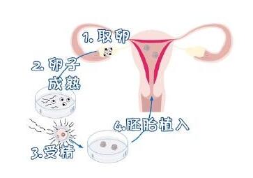 胚胎移植后能不能吃红心猕猴桃