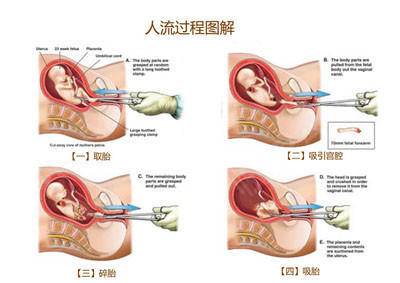 供卵做私立代生试管二代和三代哪个成功率