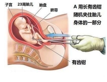 第三代供卵自怀借卵试管不是自己的认准康贝贝