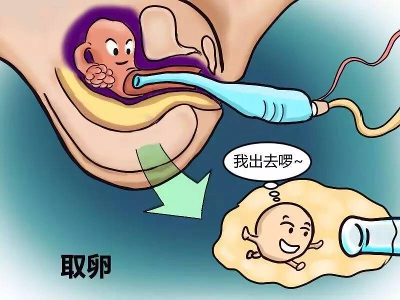 供卵试管解冻生第二胎流程