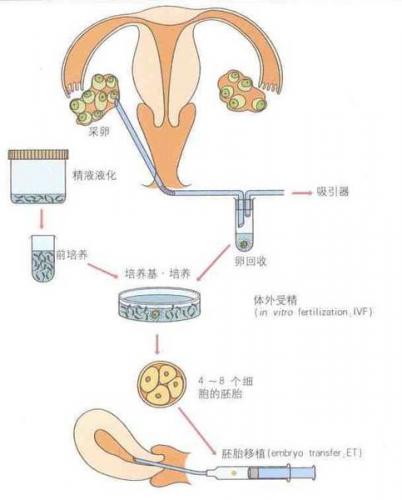 武汉仁济一代供卵试管费用
