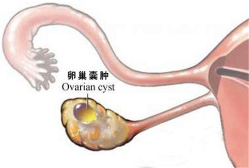 第三代供卵试管医院排名