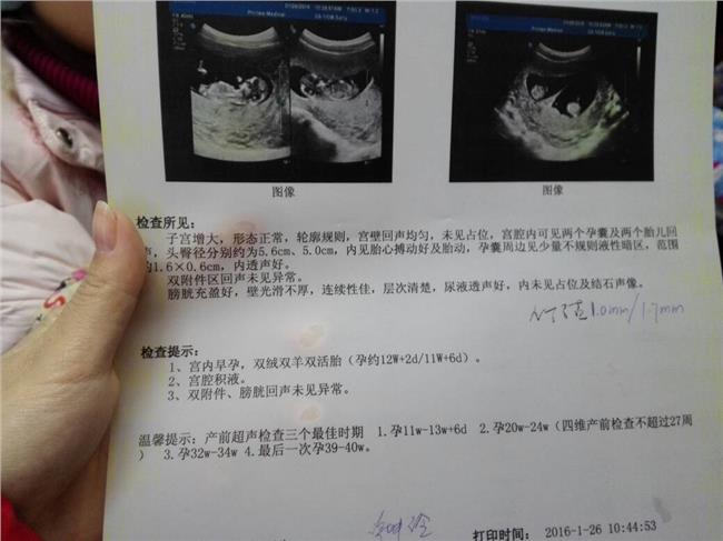 单亲代生孩子的联系方式武汉市什么时期合法