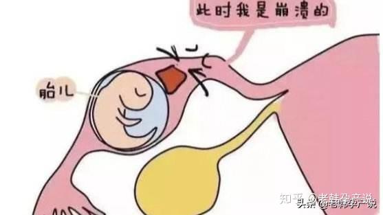 健康_黄体素助孕？真的有效吗？