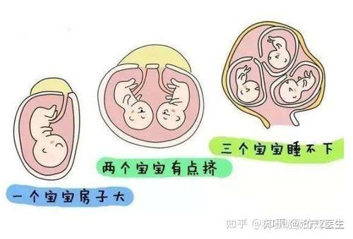 第三代怎么去试管代怀优点和缺点,做之前你了解了几个