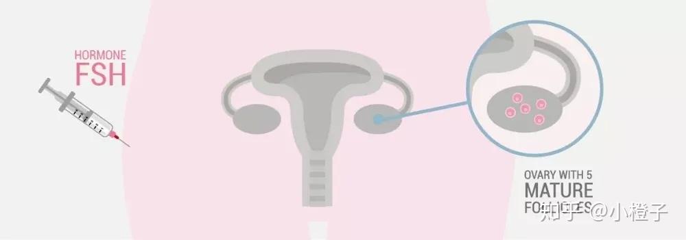 医院借卵试管代怀机构费用估算参考-武汉省人民医院哪里有女人代
