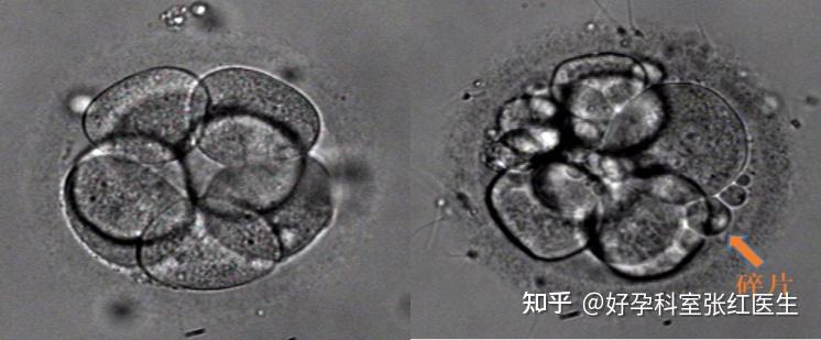 2024年西京医院三代助孕公司助孕一次大概需要多少钱（附更新试管费用及成功率）