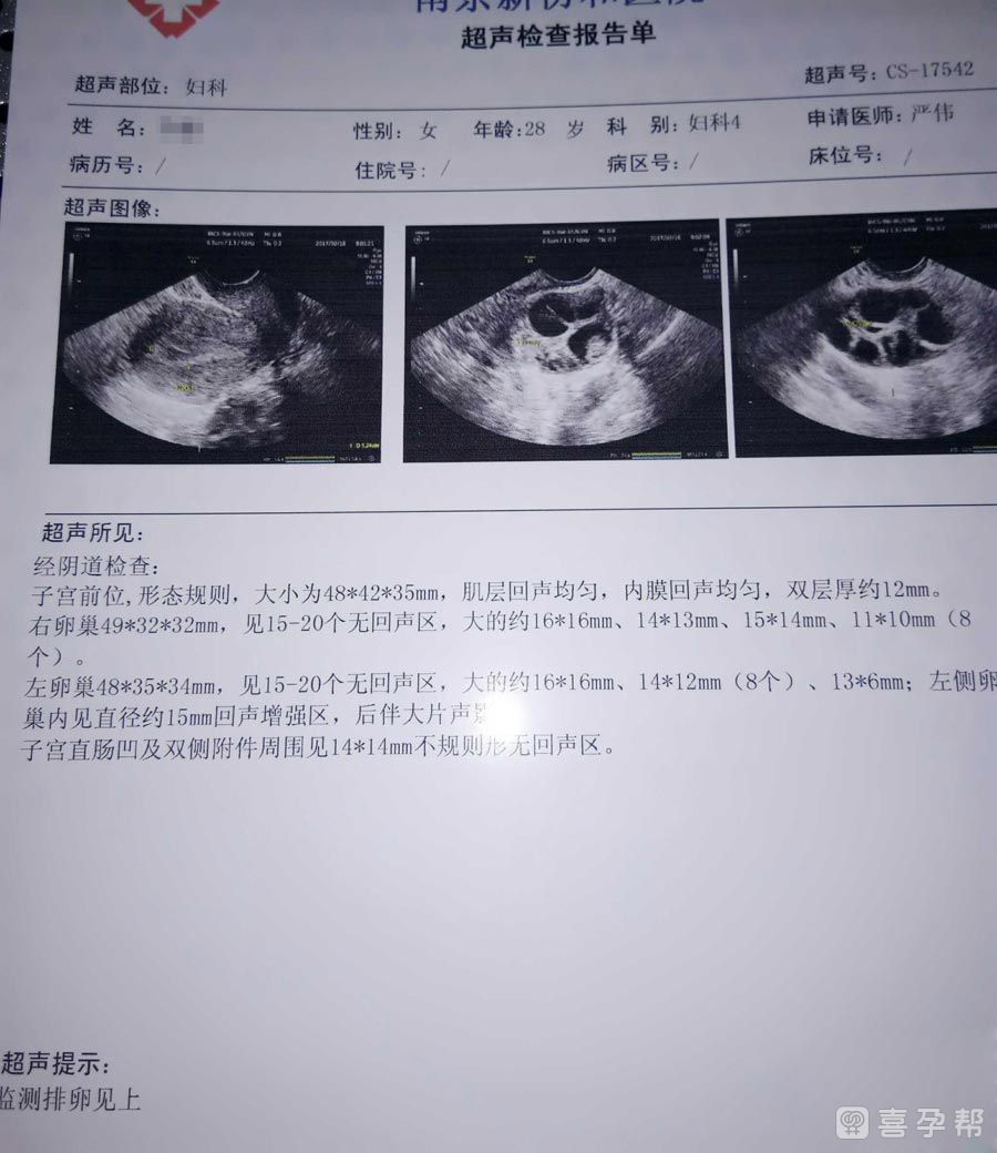 武汉三院试管整个流程+最全北医三院试管流程